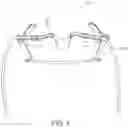 Fig. 02 - Intra-oral appliance