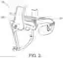 Fig. 03 - Intra-oral appliance