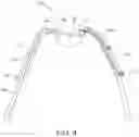 Fig. 05 - Intra-oral appliance