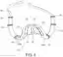 Fig. 07 - Intra-oral appliance