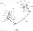 Fig. 08 - Intra-oral appliance