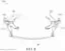 Fig. 10 - Intra-oral appliance