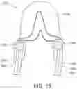 Fig. 14 - Intra-oral appliance