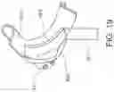 Fig. 20 - Intra-oral appliance