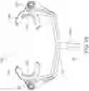Fig. 21 - Intra-oral appliance