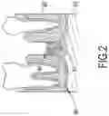 Fig. 03 - Removing Device for Dentistry