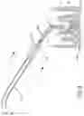 Fig. 04 - Removing Device for Dentistry