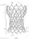 Fig. 02 - Valve prosthesis frames