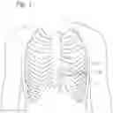 Fig. 02 - Transapical heart valve delivery system