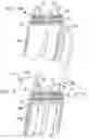 Fig. 09 - Valve suturing and implantation procedures