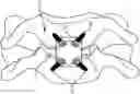 Fig. 01 - CLOWARD-STYLE CERVICAL MESH CAGE WITH LATERAL STABILIZERS