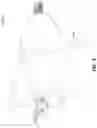 Fig. 04 - EXPANDABLE INTERBODY FUSION DEVICE FOR USE WITH POSTERIOR TO LATERAL APPROACH
