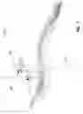 Fig. 08 - EXPANDABLE INTERBODY FUSION DEVICE FOR USE WITH POSTERIOR TO LATERAL APPROACH