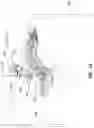 Fig. 14 - EXPANDABLE INTERBODY FUSION DEVICE FOR USE WITH POSTERIOR TO LATERAL APPROACH