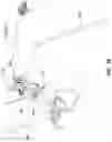 Fig. 17 - EXPANDABLE INTERBODY FUSION DEVICE FOR USE WITH POSTERIOR TO LATERAL APPROACH