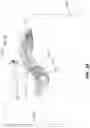 Fig. 19 - EXPANDABLE INTERBODY FUSION DEVICE FOR USE WITH POSTERIOR TO LATERAL APPROACH