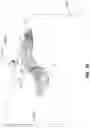 Fig. 21 - EXPANDABLE INTERBODY FUSION DEVICE FOR USE WITH POSTERIOR TO LATERAL APPROACH
