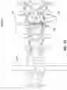Fig. 24 - EXPANDABLE INTERBODY FUSION DEVICE FOR USE WITH POSTERIOR TO LATERAL APPROACH