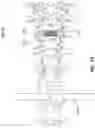 Fig. 26 - EXPANDABLE INTERBODY FUSION DEVICE FOR USE WITH POSTERIOR TO LATERAL APPROACH