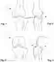 Fig. 02 - Apparatus and method for evaluating knee geometry
