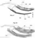 Fig. 07 - Apparatus and method for evaluating knee geometry