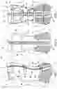 Fig. 02 - ORTHOPAEDIC BRACE AND METHOD FOR CUSTOMISING AN ORTHOPAEDIC BRACE