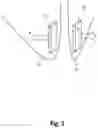 Fig. 02 - DEVICE AND METHOD FOR MANAGING OBSTRUCTIVE SLEEP APNEA