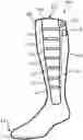 Fig. 01 - APPARATUS AND METHOD FOR APPLYING COMPRESSION