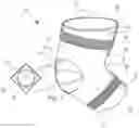 Fig. 02 - Treatment Sleeve System