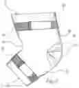 Fig. 03 - Treatment Sleeve System
