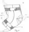 Fig. 09 - Treatment Sleeve System
