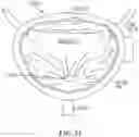 Fig. 34 - IMPLANTABLE DEPOTS FOR THE LOCALIZED, SUSTAINED, CONTROLLED RELEASE OF THERAPEUTIC AGENTS TO TREAT CANCER AND RELATED SYMPTOMS AND CONDITIONS