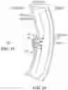 Fig. 35 - IMPLANTABLE DEPOTS FOR THE LOCALIZED, SUSTAINED, CONTROLLED RELEASE OF THERAPEUTIC AGENTS TO TREAT CANCER AND RELATED SYMPTOMS AND CONDITIONS