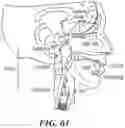 Fig. 41 - IMPLANTABLE DEPOTS FOR THE LOCALIZED, SUSTAINED, CONTROLLED RELEASE OF THERAPEUTIC AGENTS TO TREAT CANCER AND RELATED SYMPTOMS AND CONDITIONS