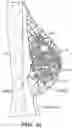 Fig. 43 - IMPLANTABLE DEPOTS FOR THE LOCALIZED, SUSTAINED, CONTROLLED RELEASE OF THERAPEUTIC AGENTS TO TREAT CANCER AND RELATED SYMPTOMS AND CONDITIONS