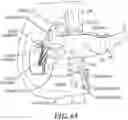 Fig. 44 - IMPLANTABLE DEPOTS FOR THE LOCALIZED, SUSTAINED, CONTROLLED RELEASE OF THERAPEUTIC AGENTS TO TREAT CANCER AND RELATED SYMPTOMS AND CONDITIONS