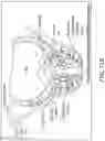 Fig. 49 - IMPLANTABLE DEPOTS FOR THE LOCALIZED, SUSTAINED, CONTROLLED RELEASE OF THERAPEUTIC AGENTS TO TREAT CANCER AND RELATED SYMPTOMS AND CONDITIONS