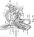 Fig. 50 - IMPLANTABLE DEPOTS FOR THE LOCALIZED, SUSTAINED, CONTROLLED RELEASE OF THERAPEUTIC AGENTS TO TREAT CANCER AND RELATED SYMPTOMS AND CONDITIONS