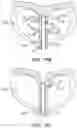 Fig. 59 - IMPLANTABLE DEPOTS FOR THE LOCALIZED, SUSTAINED, CONTROLLED RELEASE OF THERAPEUTIC AGENTS TO TREAT CANCER AND RELATED SYMPTOMS AND CONDITIONS