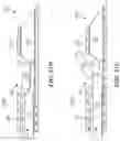 Fig. 63 - IMPLANTABLE DEPOTS FOR THE LOCALIZED, SUSTAINED, CONTROLLED RELEASE OF THERAPEUTIC AGENTS TO TREAT CANCER AND RELATED SYMPTOMS AND CONDITIONS