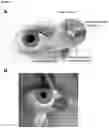 Fig. 03 - OCULAR INSERT CONTAINING A GLUCOCORTICOID