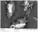 Fig. 04 - POWDER FORMULATION FOR INTRANASAL ADMINISTRATION, AND MANUFACTURING METHOD THEREOF