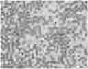 Fig. 01 - COMPOSITIONS OF DISPERSED PHASE FOR PREPARATION OF APIXABAN-LOADED MICROSPHERES AND BIOCOMPATIBLE POLYMER-BASED APIXABAN-LOADED MICROSPHERES PREPARED THEREFROM