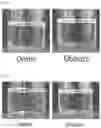 Fig. 04 - COMPOSITIONS OF DISPERSED PHASE FOR PREPARATION OF APIXABAN-LOADED MICROSPHERES AND BIOCOMPATIBLE POLYMER-BASED APIXABAN-LOADED MICROSPHERES PREPARED THEREFROM