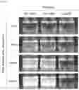 Fig. 05 - COMPOSITIONS OF DISPERSED PHASE FOR PREPARATION OF APIXABAN-LOADED MICROSPHERES AND BIOCOMPATIBLE POLYMER-BASED APIXABAN-LOADED MICROSPHERES PREPARED THEREFROM