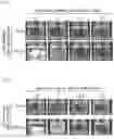 Fig. 06 - COMPOSITIONS OF DISPERSED PHASE FOR PREPARATION OF APIXABAN-LOADED MICROSPHERES AND BIOCOMPATIBLE POLYMER-BASED APIXABAN-LOADED MICROSPHERES PREPARED THEREFROM