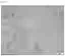 Fig. 07 - COMPOSITIONS OF DISPERSED PHASE FOR PREPARATION OF APIXABAN-LOADED MICROSPHERES AND BIOCOMPATIBLE POLYMER-BASED APIXABAN-LOADED MICROSPHERES PREPARED THEREFROM