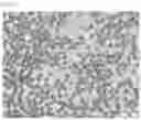 Fig. 09 - COMPOSITIONS OF DISPERSED PHASE FOR PREPARATION OF APIXABAN-LOADED MICROSPHERES AND BIOCOMPATIBLE POLYMER-BASED APIXABAN-LOADED MICROSPHERES PREPARED THEREFROM
