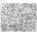 Fig. 10 - COMPOSITIONS OF DISPERSED PHASE FOR PREPARATION OF APIXABAN-LOADED MICROSPHERES AND BIOCOMPATIBLE POLYMER-BASED APIXABAN-LOADED MICROSPHERES PREPARED THEREFROM