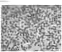 Fig. 11 - COMPOSITIONS OF DISPERSED PHASE FOR PREPARATION OF APIXABAN-LOADED MICROSPHERES AND BIOCOMPATIBLE POLYMER-BASED APIXABAN-LOADED MICROSPHERES PREPARED THEREFROM